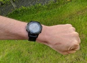 An arm with Garmin smartwatch